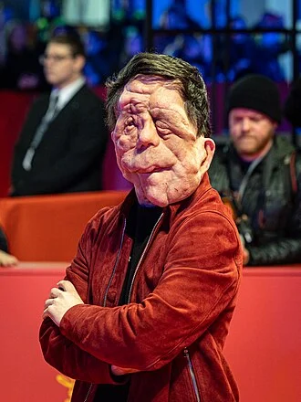 Adam Pearson (actor) height profile photo