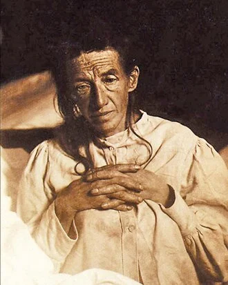 Auguste Deter height profile photo