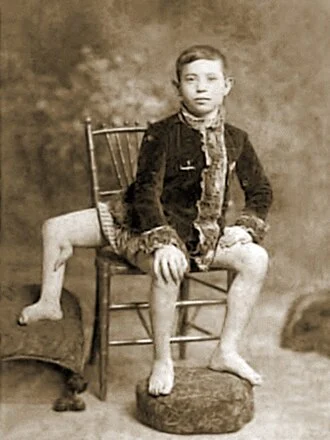 Frank Lentini height profile photo