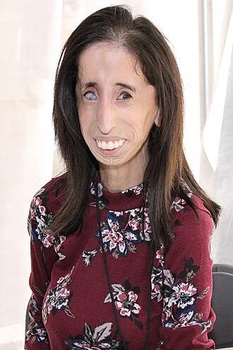 Lizzie Velásquez height profile photo