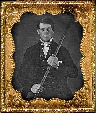 Phineas Gage height profile photo