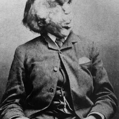 Joseph Merrick height profile photo