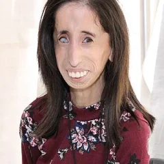 Lizzie Velásquez height profile photo