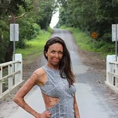 Turia Pitt height profile photo