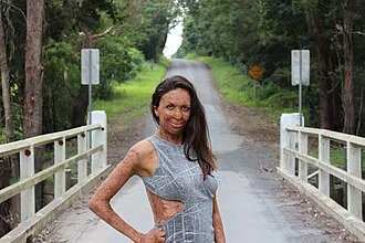 Turia Pitt height profile photo